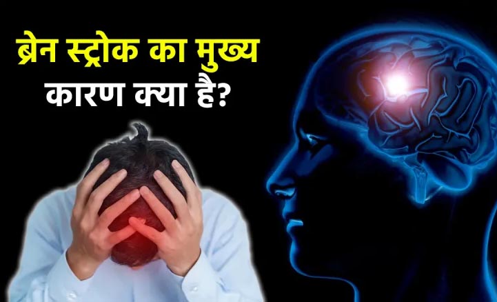 हेल्दी इंसान को भी होता है स्ट्रोक का खतरा? ये लक्षण दिखें तो हो जाएं सावधान 1 Untitled 4 copy
