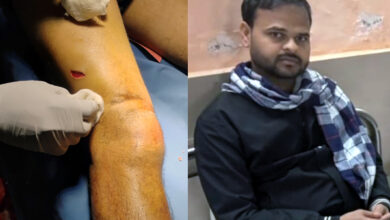 टीटीई पर चाकूओं से हमला,नगदी व मोबाइल लूट कर फरार 8 02 29