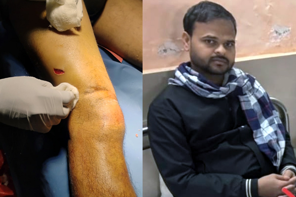 टीटीई पर चाकूओं से हमला,नगदी व मोबाइल लूट कर फरार 1 02 29