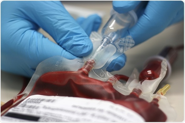 Blood Transusion shutterstock 77757421