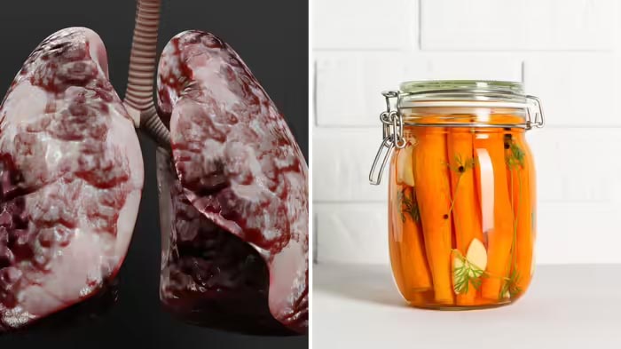 इन चीजों के दम पर पैर पसारता है कैंसर, शुरू करें दूर रहना 1 Untitled 6 copy 5