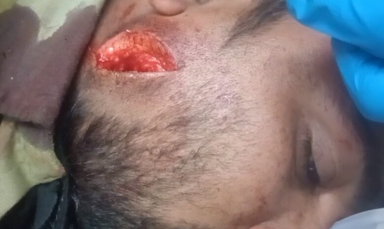 ghayal