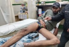 विक्टोरिया अस्पताल में गोली लगने से घायल युवक भर्ती, हनुमानताल पुलिस जांच में जुटी 17 IMG 20260106 WA0080