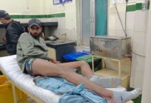 खुद की पिस्टल से हुआ था फायर,पुलिस जांच में खुलासा 13 WhatsApp Image 2026 01 06 at 22.53.56