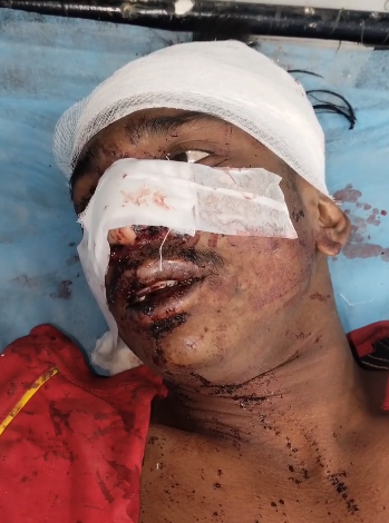 पुराने विवाद को लेकर युवक पर चाकू से हमला 1 arera