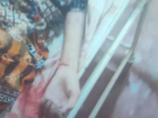 संजय नगर में नवविवाहिता की संदिग्ध मौत, दूसरी महिला से बातचीत पर पति से हुआ था विवाद - मायके पक्ष ने लगाया हत्या का आरोप 1