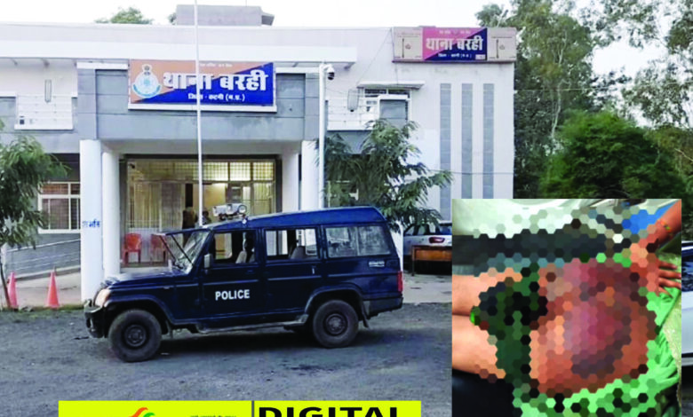 रस्सी से बांधकर आदिवासी महिला की पिटाई, महिला का आरोप : ससुर की मौत मामले में फंसाया जा रहा, पुलिस ने कहा : कार्रवाई से बचने पुलिस पर दबाव बना रही महिला 1 04 8