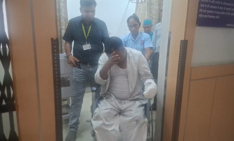 ओएफके में काम के दौरान कर्मी का हाथ झुलसा 1 IMG 20260817 WA0013