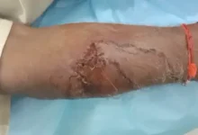 मवेशी को बचाने पहुंचे किसान पर बाघ का हमला :हाथ-पैर व पेट में आई चोटें ,गंभीर हालत में नागपुर रेफर; ग्रामीणों में दहशत... देखें पूरा वीडियो 2 20260924215840 cOW3aEKN