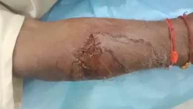 मवेशी को बचाने पहुंचे किसान पर बाघ का हमला :हाथ-पैर व पेट में आई चोटें ,गंभीर हालत में नागपुर रेफर; ग्रामीणों में दहशत... देखें पूरा वीडियो 1 20260924215840 cOW3aEKN