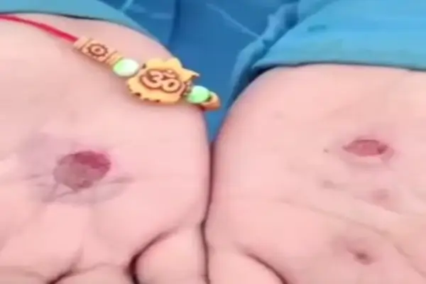 छात्रावास में तीन छात्रों से बर्बरता का आरोप : बेल्ट से पीटा, हाथों पर रखे अंगारे...जांच के लिए कमेटी गठित 1 20260925095950 2DHpMveA