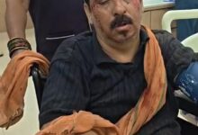 सड़क पर घायल को देखा तो रुक गई कार 2 IMG 20260913 WA0049