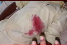छात्रावास के पास दिनदहाड़े चाकूबाजी से मचा हड़कंप!: हॉस्टल जा रहे 10वीं के छात्र को रास्ते में घेरकर पेट में घोंपा चाकू, 3 छात्र फरार 2 InCollage 20260906 130959899