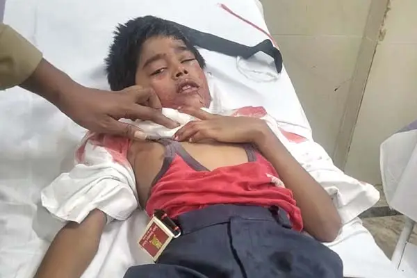 यशभारत ब्रेकिंग : स्कूली वैन को कार ने मारी जोरदार टक्कर, आठ बच्चे घायल, देखे वीडियो ..... 1