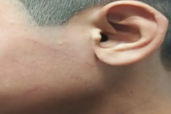 स्कूल प्रिंसिपल पर 10 वर्षीय छात्र से मारपीट का आरोप पिता बोले बेटे के कान में सुनने की परेशानी, मानसिक आघात का दावा , पुलिस जांच में जुटी 1 20261010145334 ZMEtGsOn