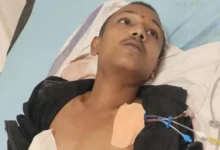 गाड़ी टकराने के विवाद में युवक को मारी गोली, मेडिकल अस्पताल में भर्ती 2 20261021131129 CIGo9yb1